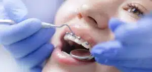 orthodontic treatments neenah